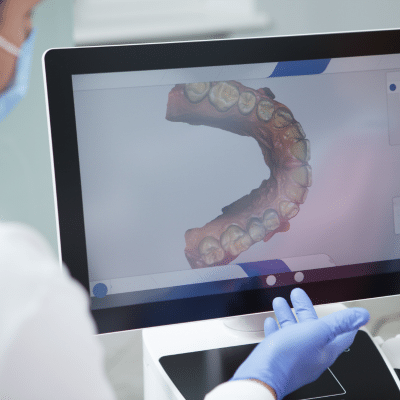 Screen with digital image of teeth mold on it, representing advanced orthodontic technology