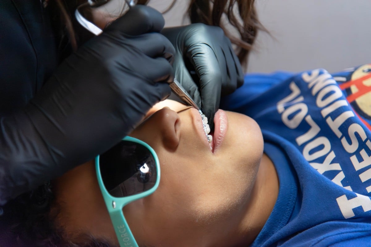 Orthodontist adjusting a child’s braces during an appointment.
